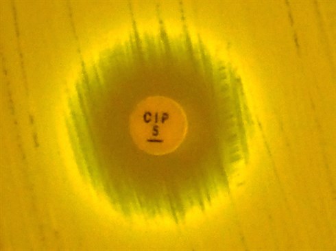bacteriano